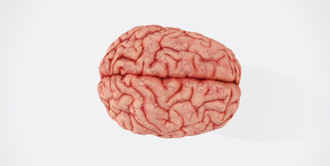 A picture of a brain