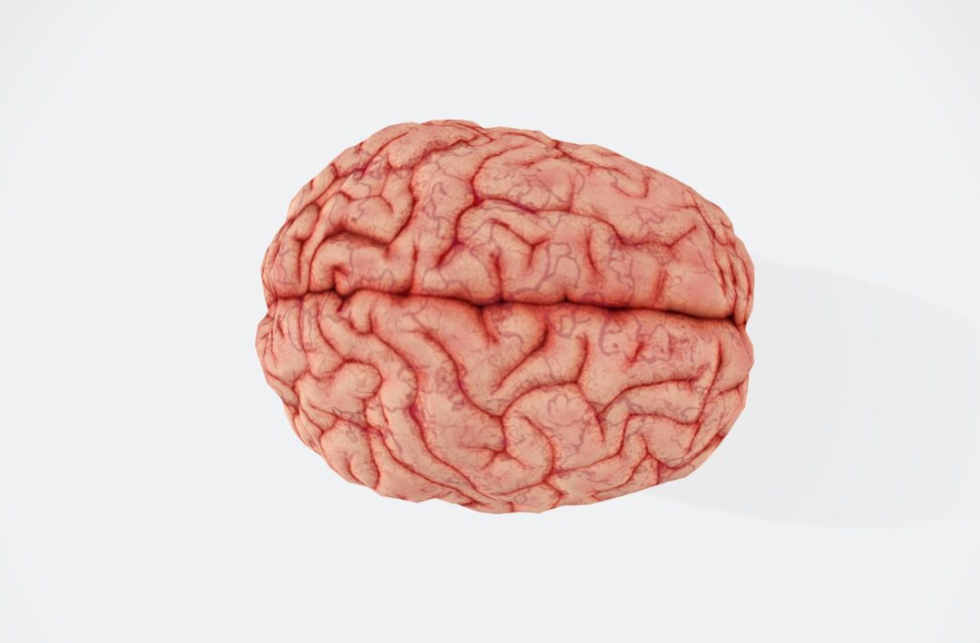 A picture of a brain